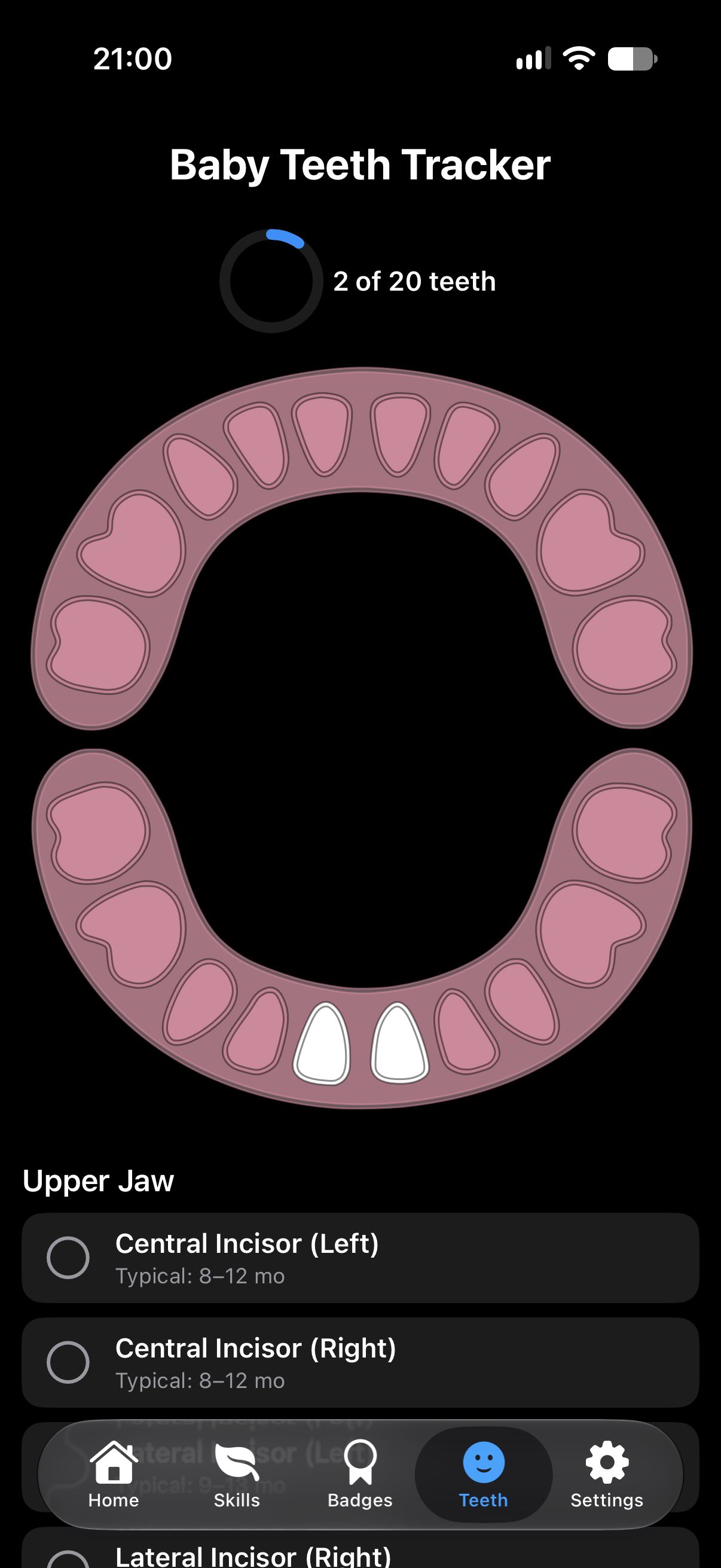 Baby teeth tracker with a jaw diagram showing 2 of 20 teeth